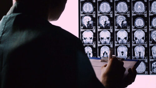Picture of a person studying scans of the brain. (The eighth amendment, prohibiting cruel and unusual punishment, is the subject of an Annenberg Classroom film. Three educators have been named to write lesson plans for the film.)